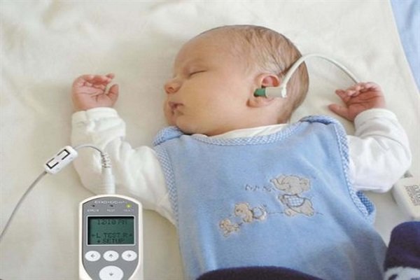 غربالگری شنوایی 93 درصد از موالید طی سال گذشته