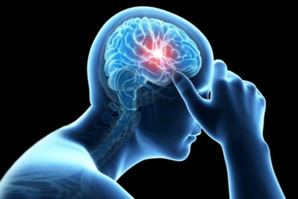 افزایش خطر سکته مغزی در ایام کرونا/شیوع مسمومیت مغزی