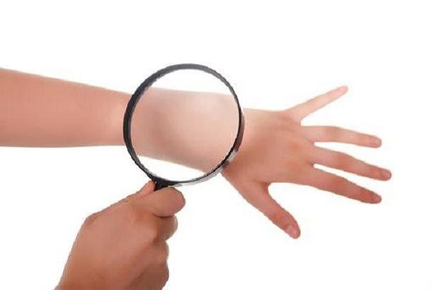 راه های جلوگیری از خارش پوست در زمستان راه های جلوگیری از خارش پوست در زمستان