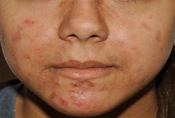 تغییر رنگ پوست را جدی بگیرید تغییر رنگ پوست را جدی بگیرید