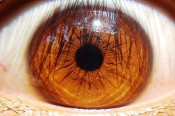 Iran among 5 countries in eye stem cell transplantation