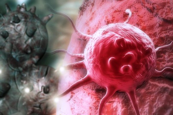 ذوب تومورهای سرطانی در تنوری از نانولوله‌های کربنی