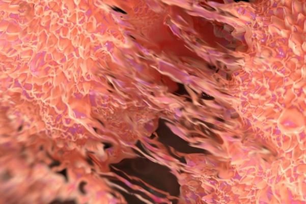 مهار رشد سلول‌های سرطانی با کنترل افزایش غیرطبیعی رگ‌زایی