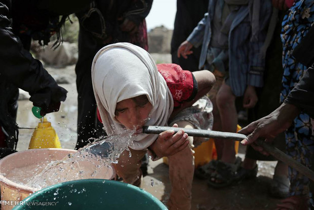 Yemen’de kolera hastalığı felaketi