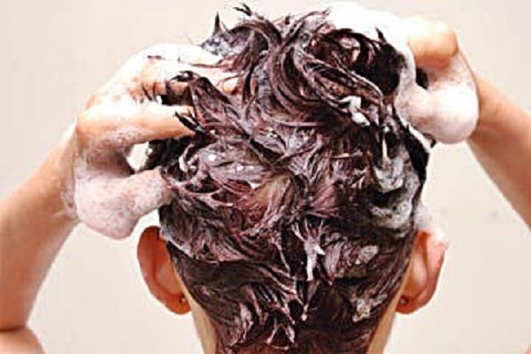 بارانداز شپش در مدارس خراسان شمالی؛ شیوع شپش در بین دختران دانش آموز