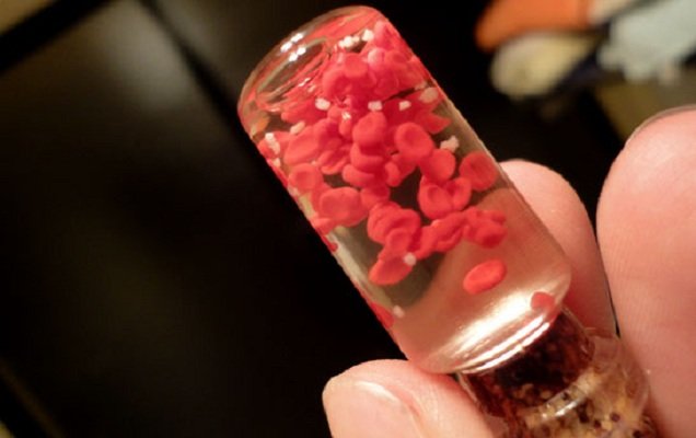 پلاكت،خون،اهداي،رفيعي،فراورده،انتقال،دست،سانتريفيوژ،پلاسما،ك ...