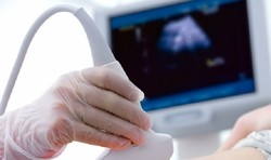 کمبود سونوگرافی در دامغان/ پزشکان رغبتی برای ماندن ندارند