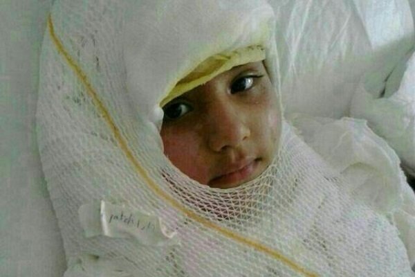 ششصد میلیون تومان؛ هزینه درمان هر بیمار سوختگی – خبرگزاری مهر | اخبار ایران و جهان