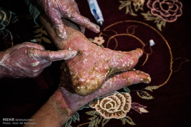 مهران، شکوفه، مهنا؛ روایت رنج و امید