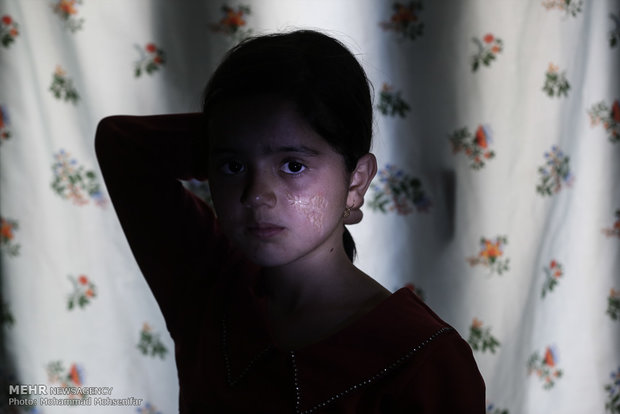 رابعه. نه ساله. از سن سه ماهگی مبتلا به بیماری. اهل روستای قره گل شرقی