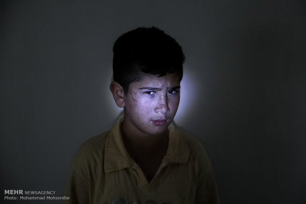 ایمان. دوازده ساله. از سن پنج سالگي مبتلا به بیماری. اهل روستای قره گل شرقی