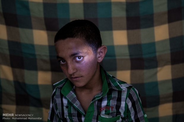 مصطفی. سیزده ساله. از سن هفت سالگي مبتلا به بیماری. اهل روستای اینچه برون