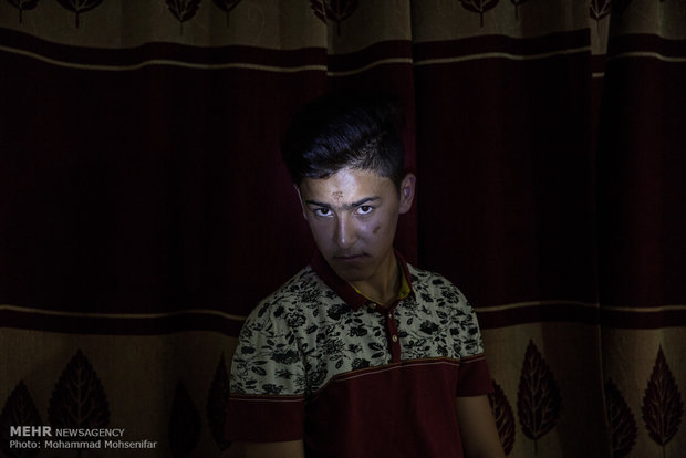 علی. شانزده ساله. از سن هشت سالگي مبتلا به بیماری. اهل روستای داشلی برون