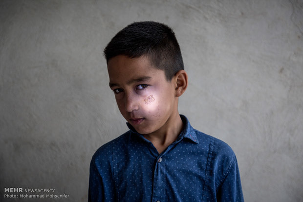 یاسر. یازده ساله. از سن چهار سالگي مبتلا به بیماری. اهل روستای قارقاشلی