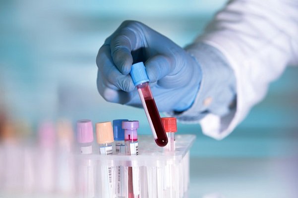 طراحی تست خون برای تشخیص زودهنگام سرطان/ امکان درمان بر اساس توالی یابی ژنتیک