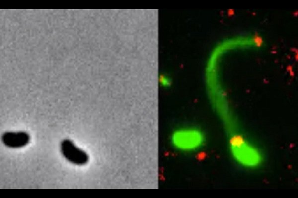 شکار تصاویر باکتری های مهاجم به «دی ان ای» انسان