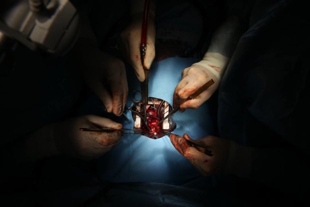 عمل جراحی کودک 15 ماهه