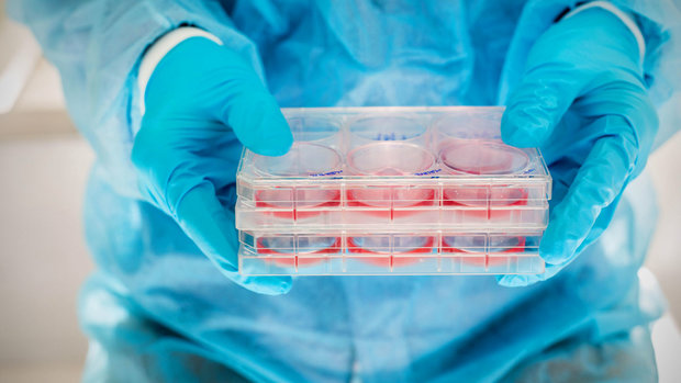 70 Iranian knowledge-based firms active in stem cells industry’