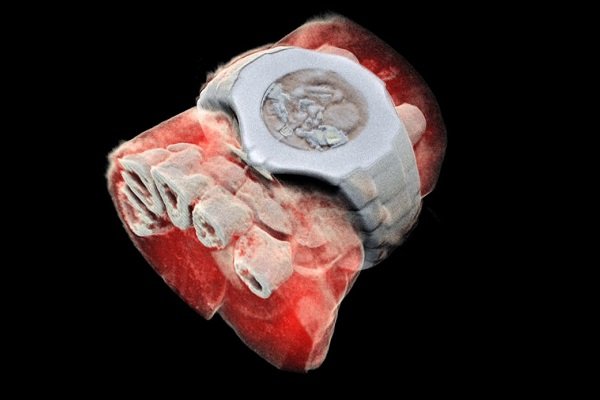 تهیه اولین عکس سه بعدی رنگی اشعه ایکس از بدن انسان