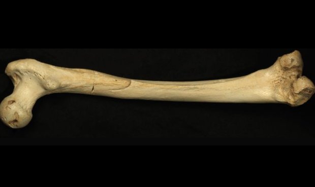 بهبود عملکرد مکانیکی-زیستی ایمپلنت‌ها با امواج فراصوت