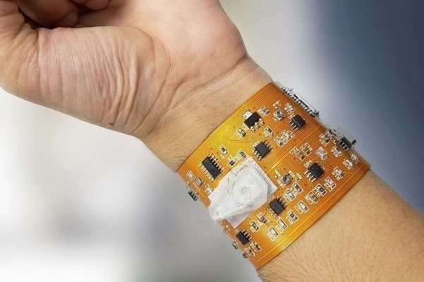 Iranian researcher develops smart medical wristband