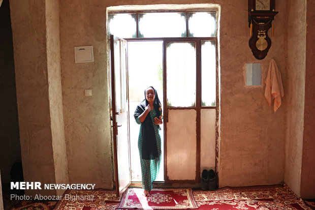 انسیه مبتلا به بیماری سندروم داون