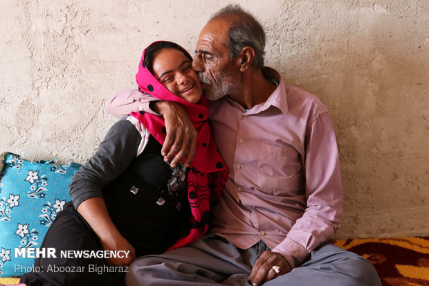 انسیه مبتلا به بیماری سندروم داون