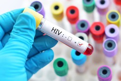 AIDS International Conference