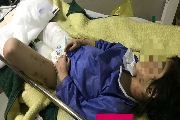 کودک۶ ساله در مهاباد مورد ضرب و شتم شدید قرار گرفت