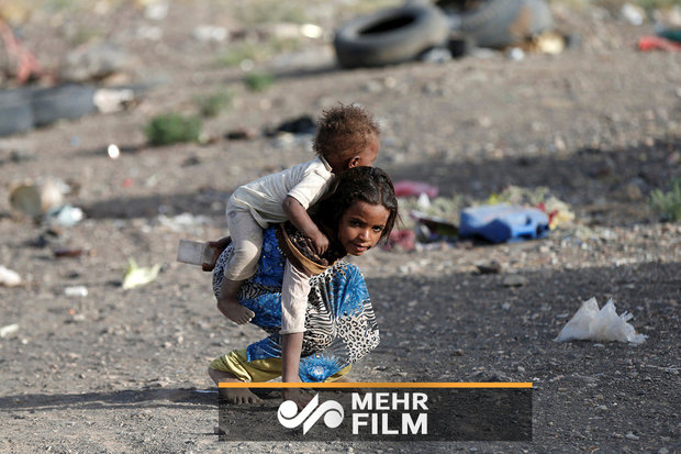 قرابة 85 ألف طفل يمني ماتوا بسبب سوء التغذية الحادّ خلال العدوان