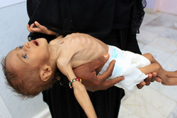 یمن میں ہر 10 منٹ میں ایک بچہ جاں بحق ہوجاتا ہے