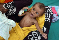 3ہزار سے زائد یمنی بچے کینسر میں مبتلا