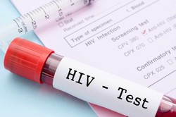 HIV/AIDS tests prior to football match scheduled