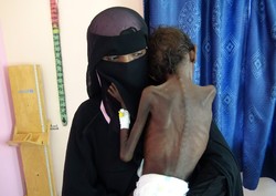 Worst famine of century may kill 400K children in Yemen