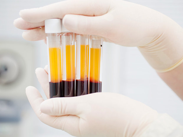 ‘High potential for local production of plasma-derived medicine’