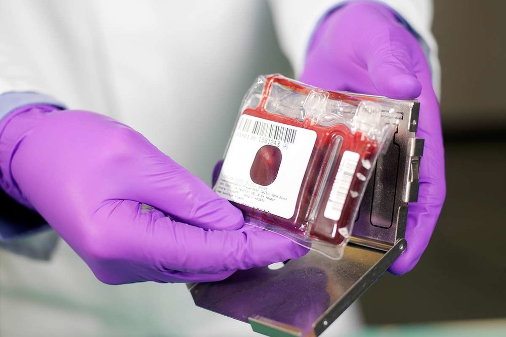 Iran home to largest cord blood bank in Middle East ...