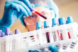 early cancer detection