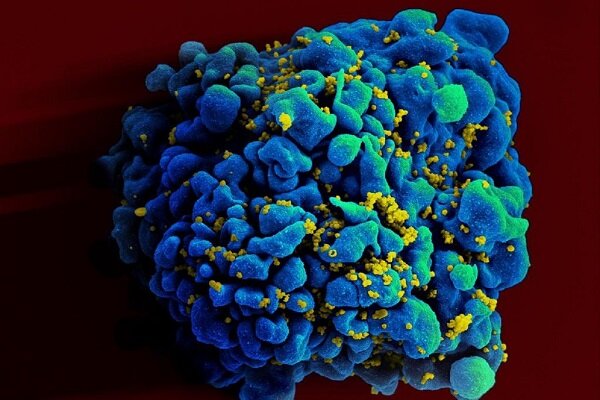 ویروس HIV فرایند پیری بدن را تسریع می کند