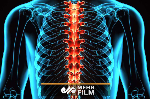 روش جدید درمان قطع نخاع