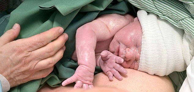 نخستین نوزاد حاصل از پیوند رحم رباتیک متولد شد (+عکس)
