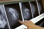 روند پیشرفت سرطان سینه در شب سریع تر است