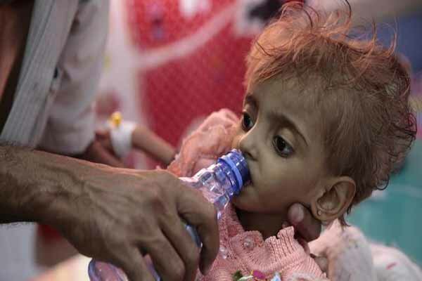 US, S. Arabia cause largest human tragedy for Yemeni children