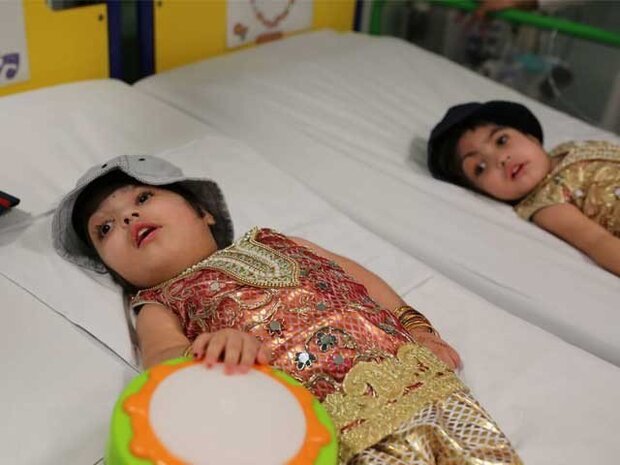 برطانیہ کے اسپتال میں کامیاب آپریشن کے بعد پاکستان کی سر جڑی جڑواں بچیوں کو علیحدہ کردیا گیا