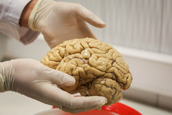 پژوهشگران مسیرهای شناخت مغز را سرعت دادند