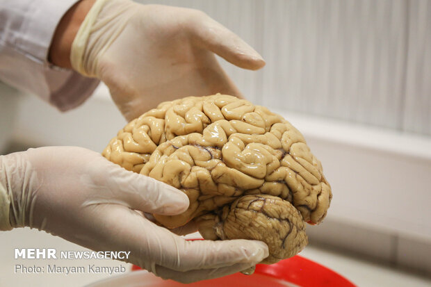 پژوهشگران مسیرهای شناخت مغز را سرعت دادند