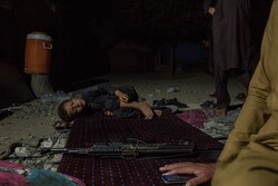 نیمی از کودکان زیر ۵ سال افغان از سوء تغدیه شدید رنج می برند