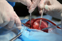 Iran among 3 major regional countries in performing organ transplants