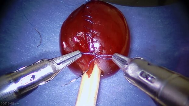 روباتی که پوست انگور را جراحی می کند