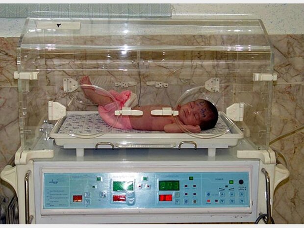 یک نوزاد از هر ۱۰۰۰ تولد زنده با سندرم داون به دنیا می آید