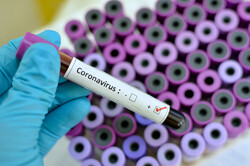 No cases of coronavirus reported in Iran: health official